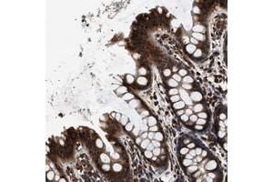 Immunohistochemical staining of human rectum with KTN1 polyclonal antibody  strong cytoplasmic positivity in glandular cells at 1:1000-1:2500 dilution. (KTN1 antibody)