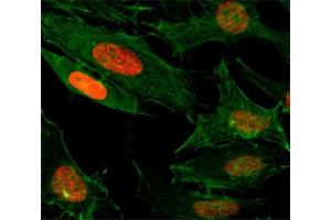 ICC/IF test of HeLa cells treated with sodium butyrate using recombinant H3K4ac antibody (red). (Recombinant Histone 3 antibody  (acLys4))