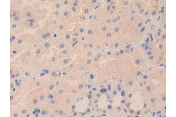 TPSD1 antibody  (AA 99-191)