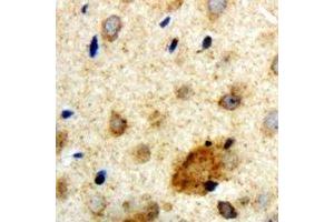 Immunohistochemical analysis of Clipin A staining in human brain formalin fixed paraffin embedded tissue section. (Coronin 1a antibody)