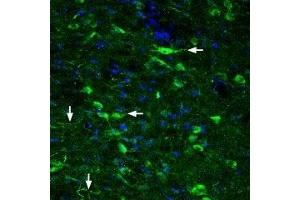 Expression of Glucagon-like peptide 2 receptor in rat hypothalamus - Immunohistochemical staining of rat hypothalamus with Anti-GLP2R (extracellular) Antibody (ABIN7043221, ABIN7044408 and ABIN7044409), (1:200). (GLP2R antibody  (1st Extracellular Loop))
