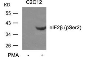 Western blot analysis of extracts from C2C12 cells untreated or treated with PMA using eIF2β (phospho-Ser2). (EIF2S2 antibody  (pSer2))