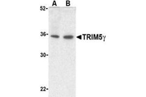 Western blot analysis of TRIM5 gamma expression in human bladder (A) and colon (B) cell lysate with TRIM5 gamma antibody at 2 μg /ml.