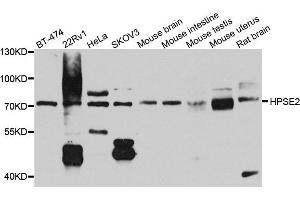 Western blot analysis of extract of various cells, using HPSE2 antibody. (Heparanase 2 antibody)