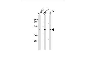 All lanes : Anti-SCD2 Antibody (C-Term) at 1:2000 dilution Lane 1: HepG2 whole cell lysate Lane 2: MCF-7 whole cell lysate Lane 3: PC-3 whole cell lysate Lysates/proteins at 20 μg per lane. (SAPCD2 antibody  (AA 333-367))