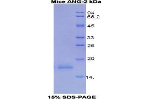 SDS-PAGE analysis of Mouse Angiopoietin 2 Protein. (Angiopoietin 2 Protein (ANGPT2))