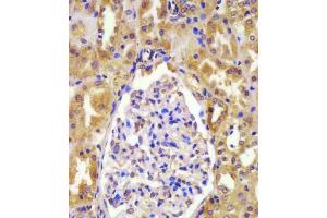 (ABIN390462 and ABIN2840832) staining VHL in human kidney tissue sections by Immunohistochemistry (IHC-P - paraformaldehyde-fixed, paraffin-embedded sections). (VHL antibody  (N-Term))