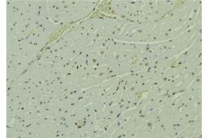 ABIN6273693 at 1/100 staining Mouse muscle tissue by IHC-P. (PAK1IP1 antibody  (C-Term))