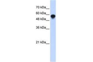 Image no. 1 for anti-Interferon Regulatory Factor 6 (IRF6) (C-Term) antibody (ABIN6742797)