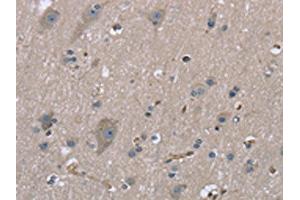 The image on the left is immunohistochemistry of paraffin-embedded Human brain tissue using ABIN7130317(MYL12B Antibody) at dilution 1/20, on the right is treated with fusion protein. (MYL12B antibody)