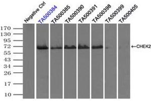 Image no. 3 for anti-Checkpoint Kinase 2 (CHEK2) antibody (ABIN1497497) (CHEK2 antibody)