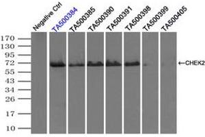 Image no. 3 for anti-Checkpoint Kinase 2 (CHEK2) antibody (ABIN1497497) (CHEK2 antibody)