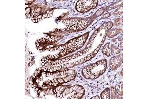 Immunohistochemical staining of human stomach with OVCH1 polyclonal antibody  shows strong cytoplasmic positivity in glandular cells. (OVCH1 antibody)