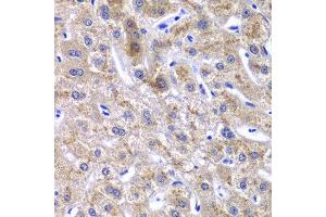 Immunohistochemistry of paraffin-embedded human liver injury using GOLM1 antibody at dilution of 1:100 (x40 lens). (GOLM1 antibody)