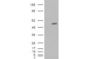 HEK293 overexpressing ALDH1A1 and probed with ABIN2561028 (mock transfection in first lane). (ALDH1A1 antibody  (C-Term))