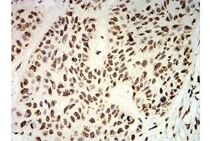 Immunohistochemistry (IHC) image for anti-Ubiquitin-Like, Containing PHD and RING Finger Domains, 1 (UHRF1) (AA 616-755) antibody (ABIN5542545)