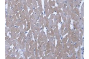 DAB staining on IHC-P; Samples: Rat Cardiac Muscle Tissue (Endothelin 3 antibody  (AA 20-167))