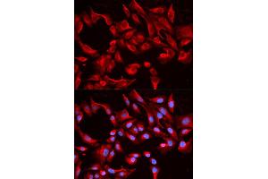 Immunofluorescence analysis of HeLa cell using BCL2L13 antibody.