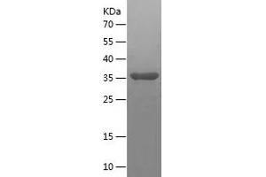 Western Blotting (WB) image for Cyclin-Dependent Kinase 2 Associated Protein 2 (CDK2AP2) (AA 1-126) protein (His-IF2DI Tag) (ABIN7283395) (CDK2AP2 Protein (AA 1-126) (His-IF2DI Tag))