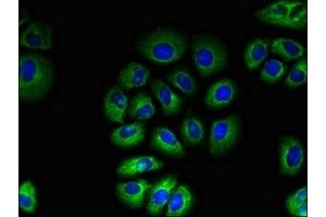 TAS1R2 antibody  (AA 183-362)