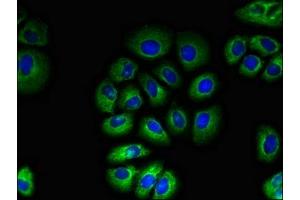 Immunofluorescent analysis of A549 cells using ABIN7171530 at dilution of 1:100 and Alexa Fluor 488-congugated AffiniPure Goat Anti-Rabbit IgG(H+L) (TAS1R2 antibody  (AA 183-362))