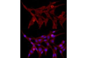 Immunofluorescence analysis of PC-12 cells using TRIM21/SS-A Rabbit pAb (ABIN3015761, ABIN3015762, ABIN3015763 and ABIN6219108) at dilution of 1:50 (40x lens). (TRIM21 antibody  (AA 80-330))