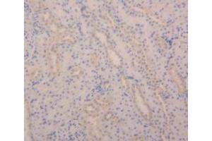 Detection of ANGPT2 in Rat Kidney Tissue using Polyclonal Antibody to Angiopoietin 2 (ANGPT2) (Angiopoietin 2 antibody  (AA 33-243))
