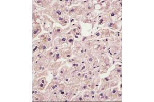 (ABIN6242410 and ABIN6578870) staining IL1R in human liver tissue sections by Immunohistochemistry (IHC-P - paraformaldehyde-fixed, paraffin-embedded sections). (IL1RAP antibody  (AA 484-518))