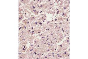 (ABIN6242410 and ABIN6578870) staining IL1R in human liver tissue sections by Immunohistochemistry (IHC-P - paraformaldehyde-fixed, paraffin-embedded sections). (IL1RAP antibody  (AA 484-518))