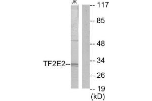 Western Blotting (WB) image for anti-General Transcription Factor IIE, Polypeptide 2 (GTF2E2) (Internal Region) antibody (ABIN1849294)
