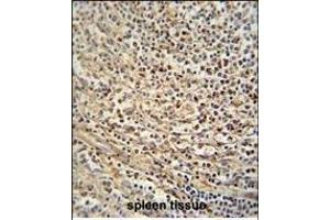 GSDMC antibody (Center) (ABIN654726 and ABIN2844414) immunohistochemistry analysis in formalin fixed and paraffin embedded human spleen tissue followed by peroxidase conjugation of the secondary antibody and DAB staining.
