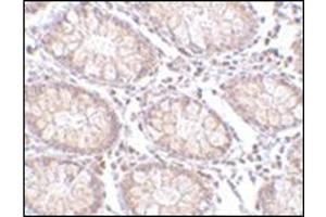 Immunohistochemistry of PTK7 in human colon tissue with this product at 5 μg/ml. (PTK7 antibody  (N-Term))
