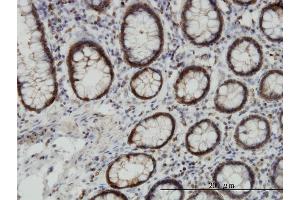 Immunoperoxidase of monoclonal antibody to EPHB3 on formalin-fixed paraffin-embedded human colon. (EPH Receptor B3 antibody  (AA 899-997))