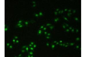 Detection of XRCC5 in Human Hela Cells using Polyclonal Antibody to X-Ray Repair Cross Complementing 5 (XRCC5) (X-Ray Repair Cross Complementing 5 (AA 251-732) antibody)