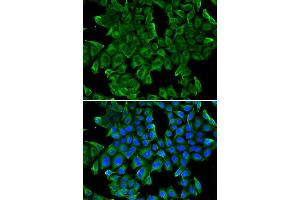 Immunofluorescence analysis of MCF-7 cell using REG3G antibody. (REG3g antibody)