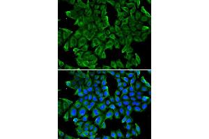 Immunofluorescence analysis of MCF-7 cell using REG3G antibody. (REG3g antibody)