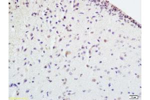 Formalin-fixed and paraffin embedded rat brain tissue labeled withAnti-EPOR Polyclonal Antibody , Unconjugated at 1:100 followed by conjugation to the secondary antibody, (SP-0023), and DAB staining (EPOR antibody  (AA 301-450))