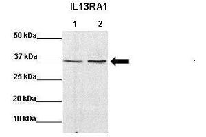 Sample Type: Lane 1:641 µg mouse CT26 lysate Lane 2: 041 µg mouse MC38 lysate Primary Antibody Dilution: 1:0000Secondary Antibody: Anti-rabbit-HRP Secondary Antibody Dilution: 1:0000 Color/Signal Descriptions: IL13RA1  Gene Name: Miranda A. (IL13 Receptor alpha 1 antibody  (N-Term))