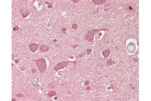 Human Brain, Cortex: Formalin-Fixed, Paraffin-Embedded (FFPE) (LNX1 antibody  (AA 260-528))