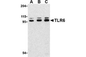Western blot analysis of TLR6 in Jurkat cell lysate with this product at (A) 0. (TLR6 antibody  (Center))
