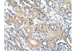 GEM antibody was used for immunohistochemistry at a concentration of 4-8 ug/ml to stain Epithelial cells of renal tubule (arrows) in Human Kidney. (GEM antibody  (C-Term))