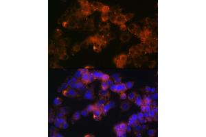 Immunofluorescence analysis of Hep G2 cells using Sonic Hedgehog (Shh) (Shh) Rabbit mAb (ABIN6131215, ABIN6147930, ABIN6147931 and ABIN7101409) at dilution of 1:100 (40x lens).