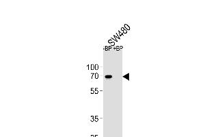 Western blot analysis of ETV5 Antibody (N-term) Pab (ABIN654690 and ABIN2844382) pre-incubated without(lane 1) and with(lane 2) blocking peptide in S cell line lysate. (ETV5 antibody  (N-Term))