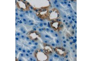 Immunohistochemical analysis of PCCB staining in human kidney formalin fixed paraffin embedded tissue section.