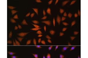 Immunofluorescence analysis of L929 cells using NRBF2 Polyclonal Antibody at dilution of 1:100. (NRBF2 antibody)