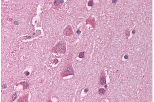 Human Brain, Cortex (formalin-fixed, paraffin-embedded) stained with HSF1 antibody ABIN214116 at 5 ug/ml followed by biotinylated goat anti-rabbit IgG secondary antibody ABIN481713, alkaline phosphatase-streptavidin and chromogen. (HSF1 antibody  (C-Term))