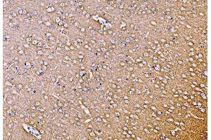 IHC analysis of SYP using anti-SYP antibody (ABIN7603120).