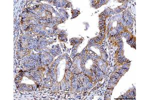 IHC analysis of Poliovirus Receptor/PVR using anti-Poliovirus Receptor/PVR antibody (ABIN7601072).