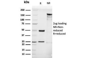 SDS-PAGE Analysis Purified LHCGR Mouse Monoclonal Antibody (LHCGR/1416). (LHCGR antibody  (AA 70-410))