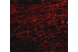 Immunofluorescence staining of human brain tissue with 20 ug/mL CLIP1 polyclonal antibody .